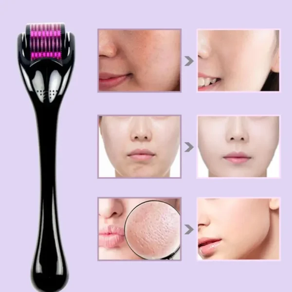 New 540 Needle Miniature for Anti-aging Skin Regeneration,Skin Tightening, and Collagen Stimulation Therapy 0.2mm 0.25mm 0.3mm - Image 6